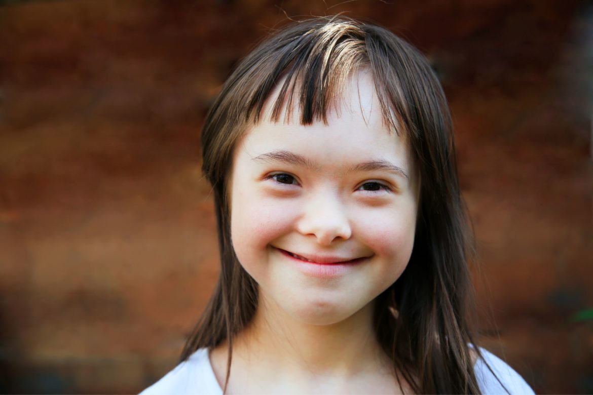 Down_Syndrome_history medical care and research_My_Angel_feat
